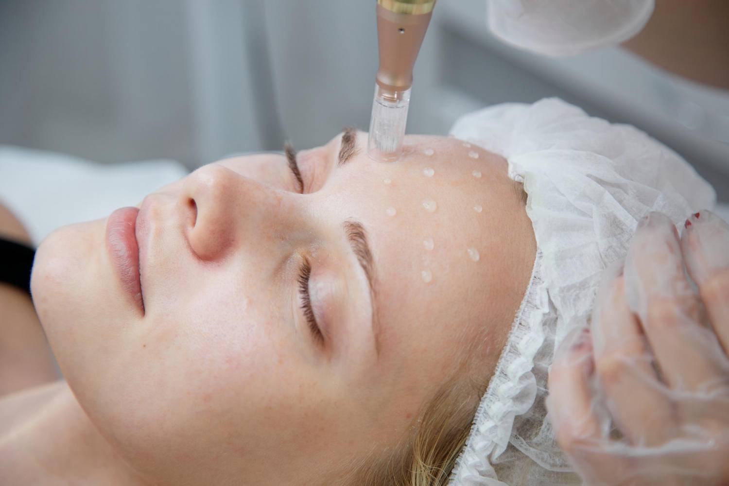 Skin radiance with biorevitalization